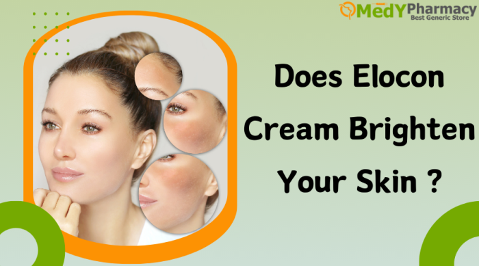 Does Elocon Cream Brighten Your Skin